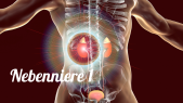 thumbnail of medium Nebenniere 1