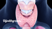 thumbnail of medium Dijodthyronin